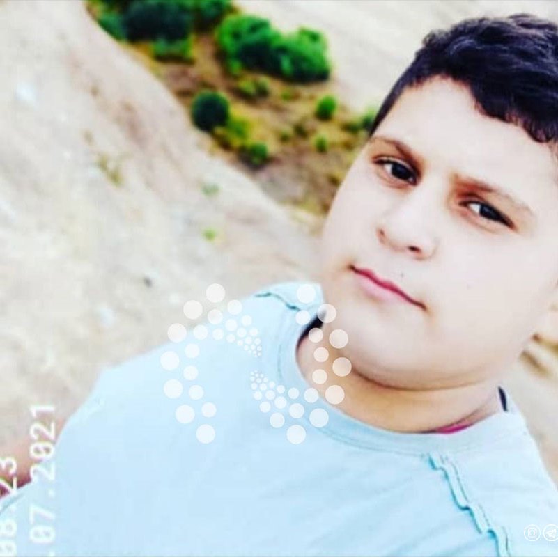 محمدرضا کودک تبریزی که امروز در شعله های آتش سوخت
